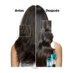 Shampoo Scalp Advanced Dermo-Regulador Anti-Irritación 250 ml - L'Oréal Professionnel - Imagen 5